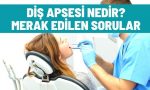 dis apsesi nedir merak edilenler