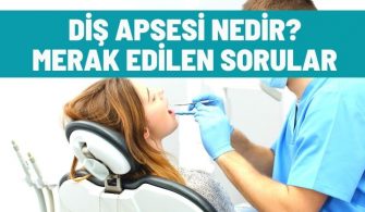 dis apsesi nedir merak edilenler