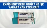 expigment krem nedir