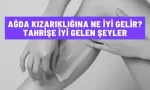 agda kizarikligina ne iyi gelir