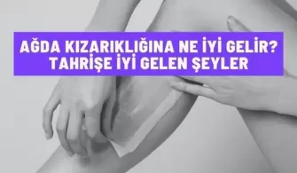 agda kizarikligina ne iyi gelir