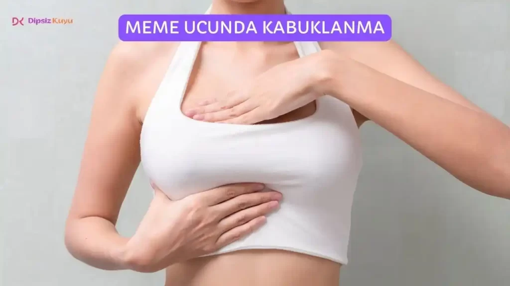 Meme Ucunda Kabuklanma Neden Olur? Neyin Belirtisi?