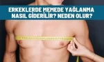 erkeklerde memede yaglanma