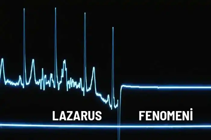 Lazarus Fenomeni Nedir?