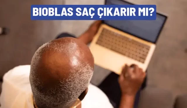 bioblas sac cikarir mi