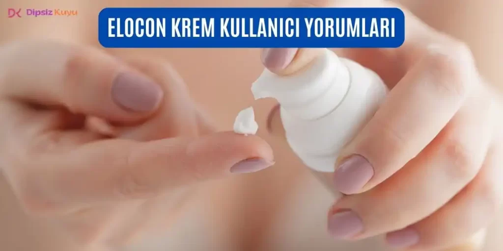 Elocon Krem Kullananlar Yorumları | Güncel Yorumlar 2026
